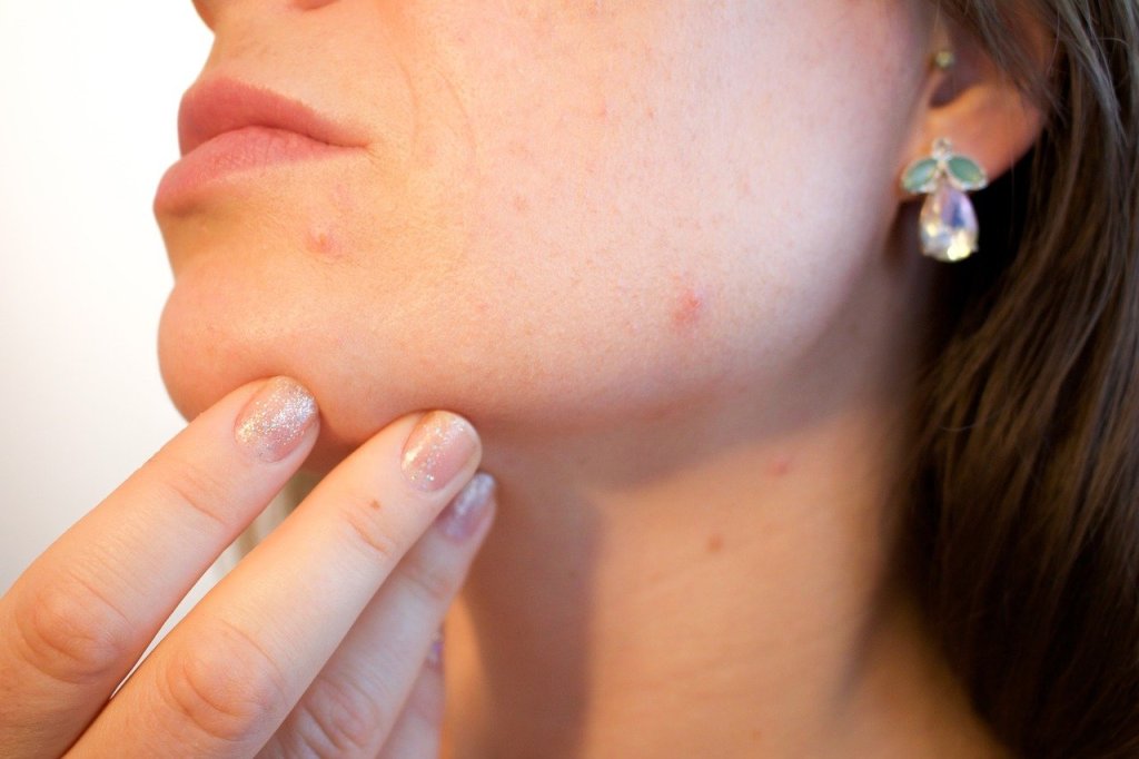 Laser Resurfacing Or Chemical Peel? This Is The Answer